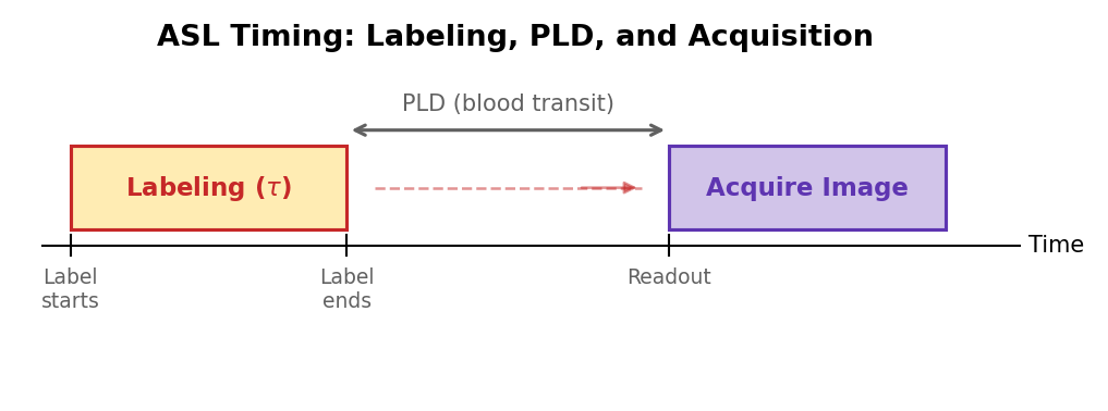 ASL timing: labeling duration, post-labeling delay, and image acquisition.