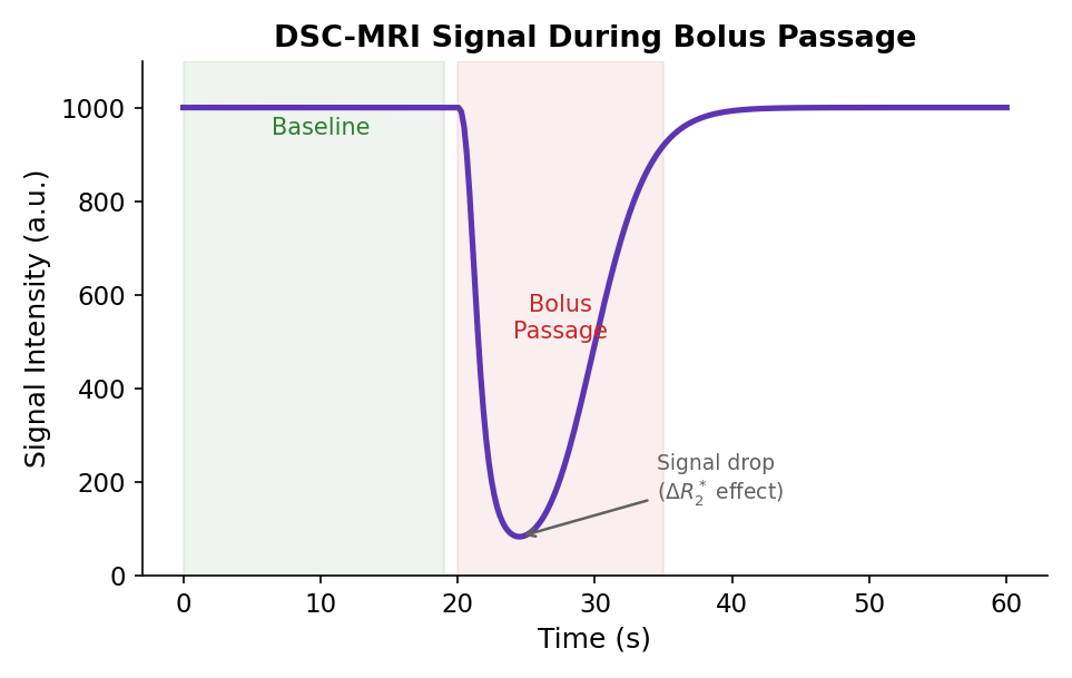 DSC signal-time curve showing signal drop during gadolinium bolus passage.